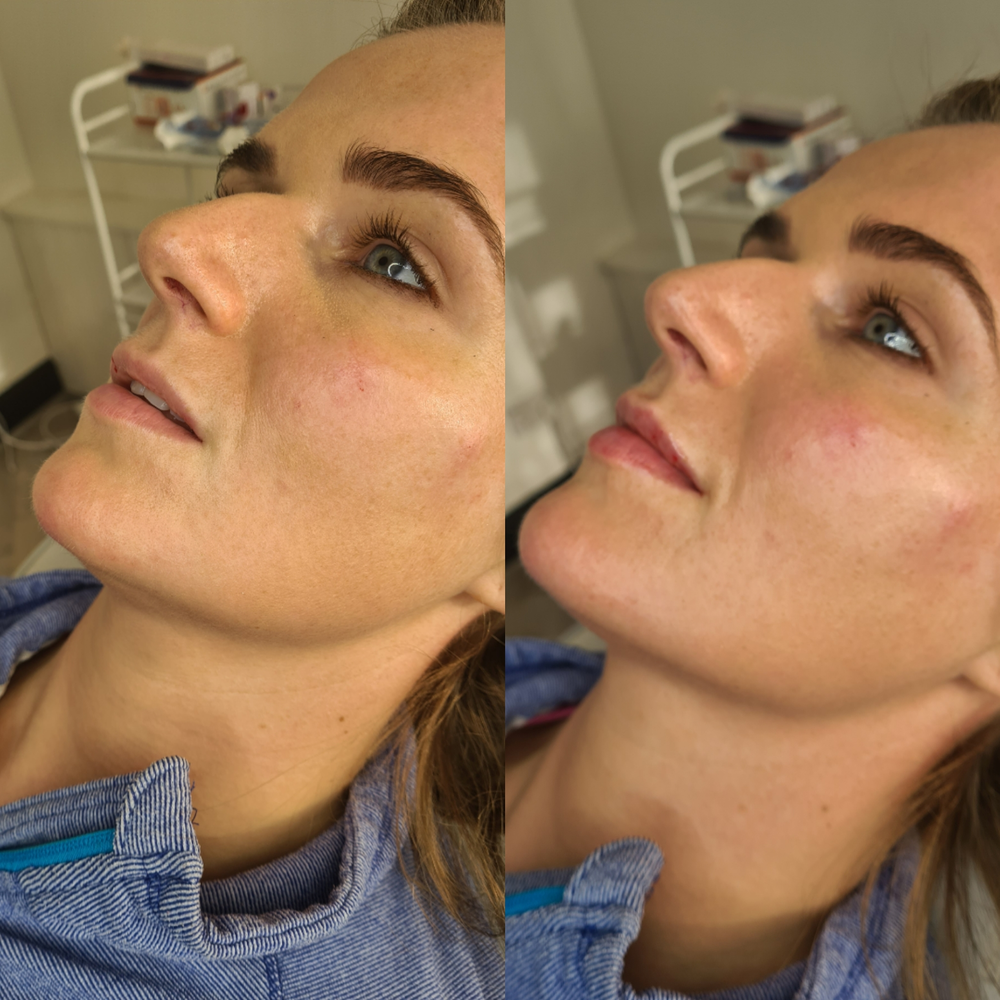 Contour Packages